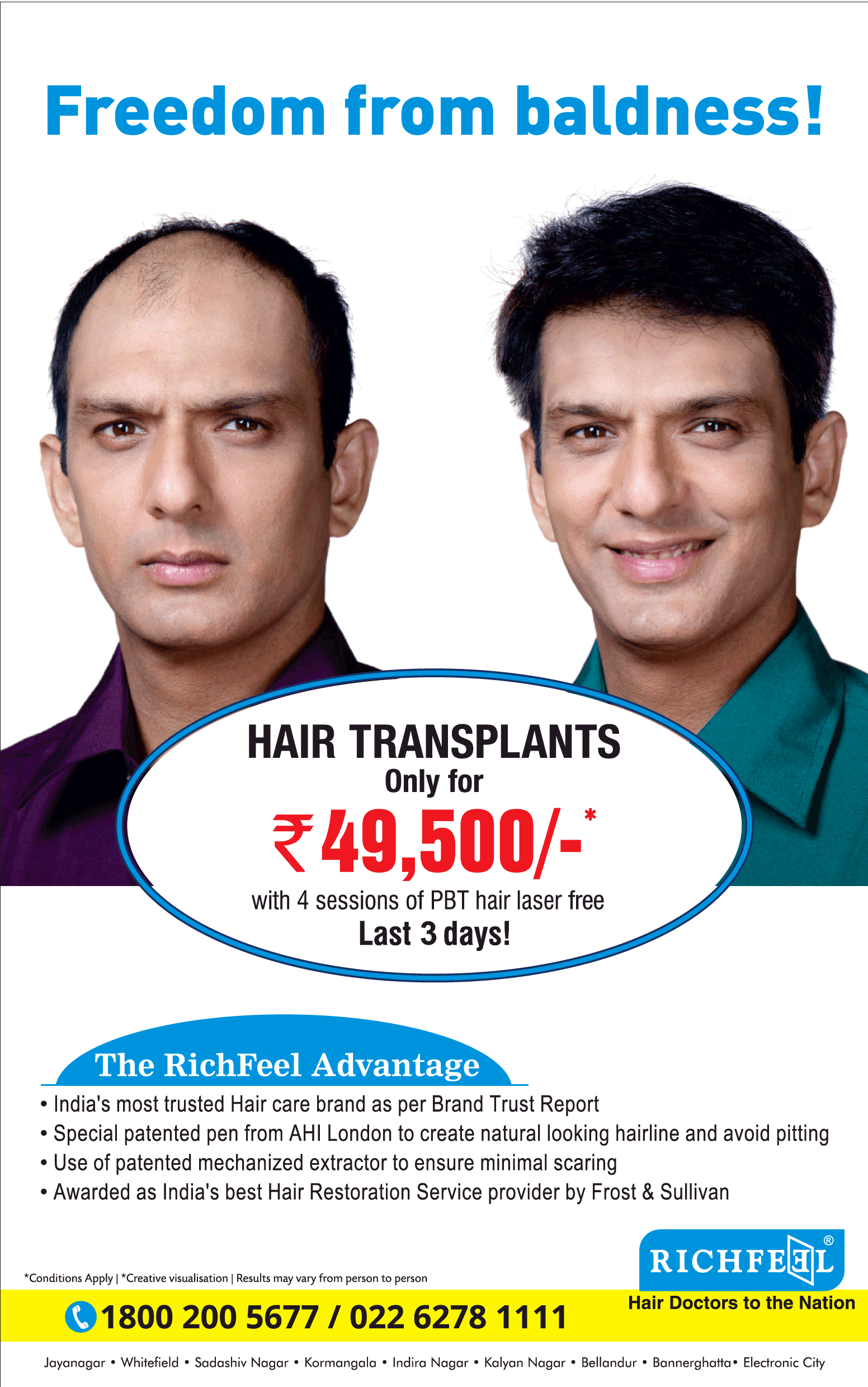 Richfeel Hair Doctors To Nation Freedom From Baldness Hair Transplants Only  For 49500 Ad - Advert Gallery