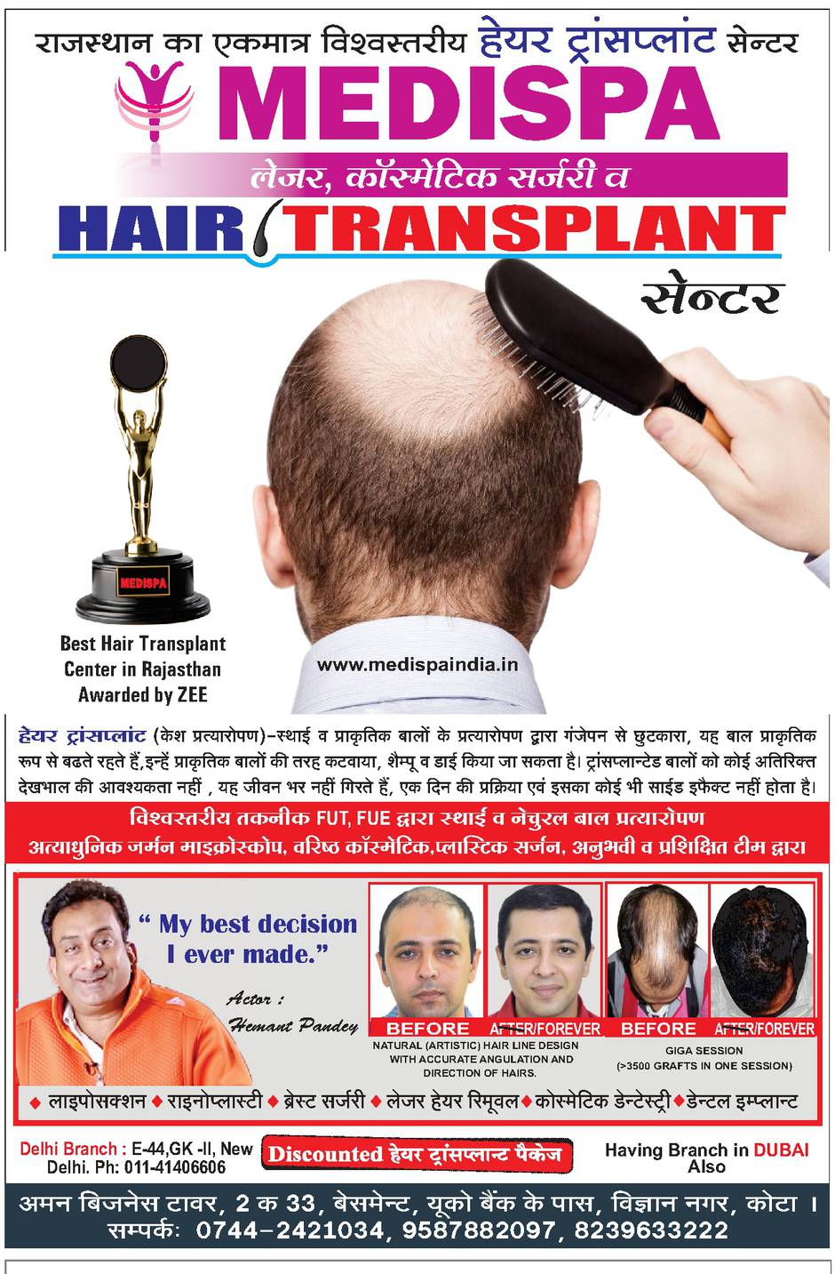 Get Cheapest Hair Transplant in Delhi Poster by Clinic Spots  Fine Art  America